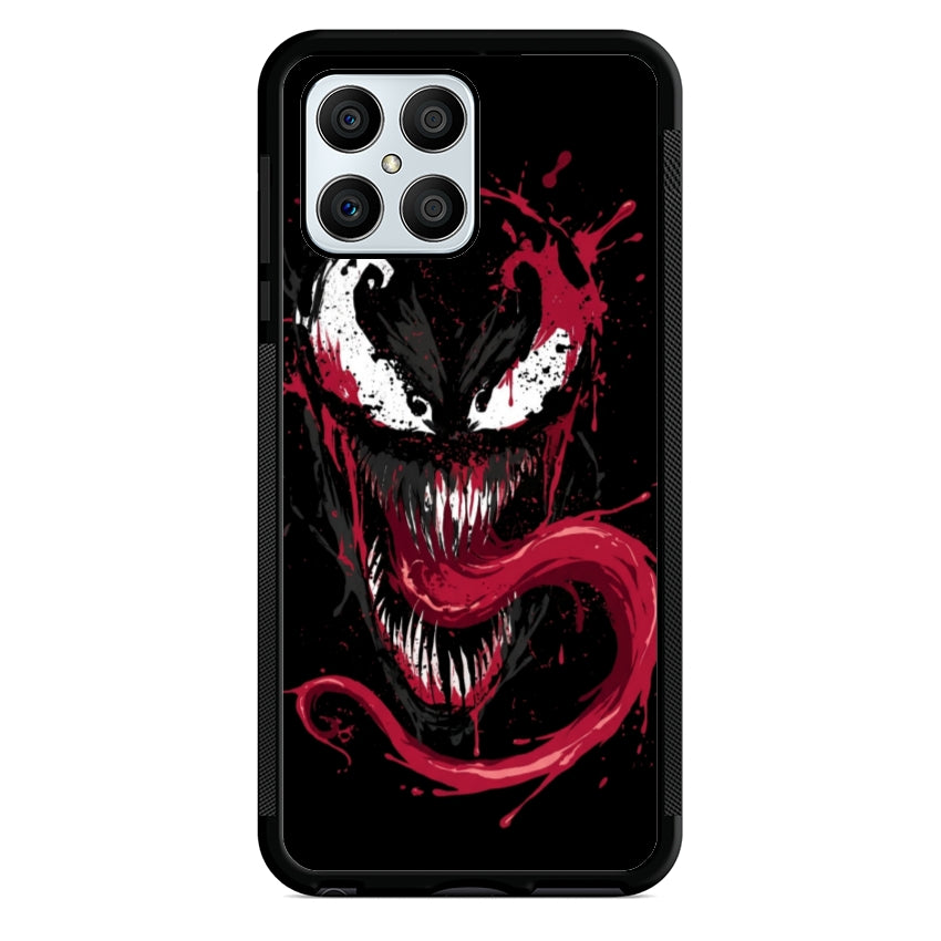 VM1- Huawei e Honor