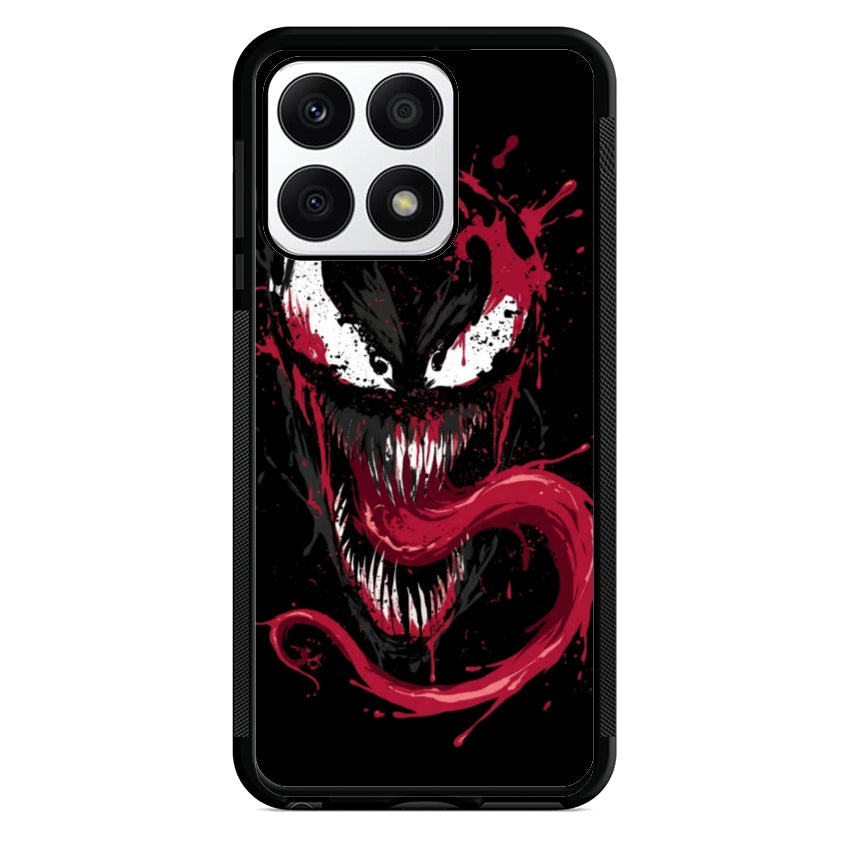 VM1- Huawei e Honor