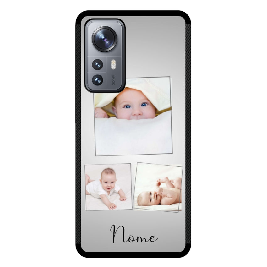 Cover 3 Foto Frame - Xiaomi, Redmi e Poco